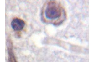 Immunohistochemistry analyzes of CaR antibody in paraffin-embedded human brain tissue. (CASR Antikörper)