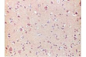 Immunohistochemistry (IHC) image for anti-Frataxin (FXN) antibody (ABIN781667) (Frataxin Antikörper)