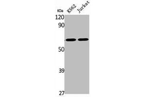 Western Blot analysis of K562 Jurkat cells using BOCT Polyclonal Antibody (SLC22A17 Antikörper  (Internal Region))