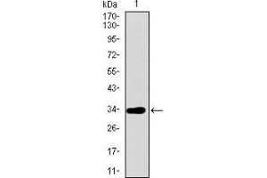 Western blot analysis using ABCG5 mAb against human ABCG5 recombinant protein. (ABCG5 Antikörper  (AA 306-367))