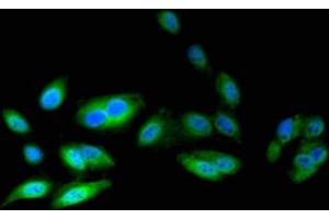 Immunofluorescent analysis of Hela cells using ABIN7145576 at dilution of 1:100 and Alexa Fluor 488-congugated AffiniPure Goat Anti-Rabbit IgG(H+L) (ATIC Antikörper  (AA 301-592))