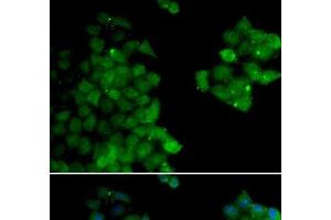 Immunofluorescence analysis of HeLa cells using PSMB10 Polyclonal Antibody (PSMB10 Antikörper)