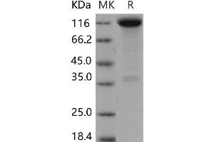 Western Blotting (WB) image for Neurotrophic Tyrosine Kinase, Receptor, Type 1 (NTRK1) (Active) protein (Fc Tag) (ABIN7320046) (TRKA Protein (Fc Tag))