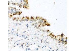 Immunohistochemistry of paraffin-embedded Mouse lung using BMP4 Polyclonal Antibody at dilution of 1:100 (40x lens). (BMP4 Antikörper)