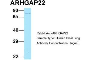Host: Rabbit  Target Name: ARHGAP22  Sample Tissue: Human Fetal Lung  Antibody Dilution: 1. (ARHGAP22 Antikörper  (C-Term))