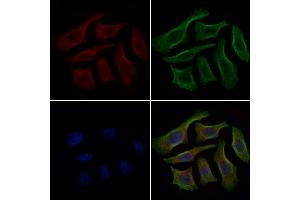 ABIN7094788 and ABIN7098839 staining HepG2 cells by IF/ICC.