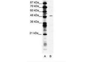 Image no. 1 for anti-Suppressor of Variegation 4-20 Homolog 1 (SUV420H1) (AA 763-812) antibody (ABIN203167) (SUV420H1 Antikörper  (AA 763-812))