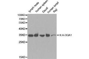 Western blot analysis of extracts of various cell lines, using HLA-DQA1 antibody. (HLA-DQA1 Antikörper  (AA 24-216))
