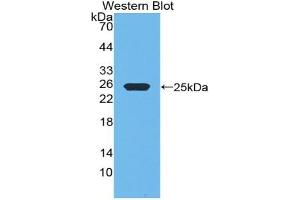 Detection of Recombinant GH, Rat using Polyclonal Antibody to Growth Hormone (GH) (Growth Hormone 1 Antikörper  (AA 28-216))