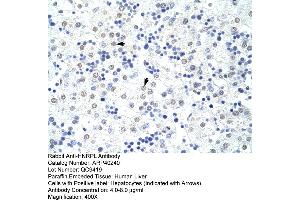 Rabbit Anti-HNRPL Antibody  Paraffin Embedded Tissue: Human Liver Cellular Data: Hepatocytes Antibody Concentration: 4. (HNRNPL Antikörper  (N-Term))