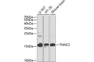 Western blot analysis of extracts of various cell lines, using TNNC2 antibody (ABIN6129604, ABIN6149353, ABIN6149354 and ABIN6223680) at 1:1000 dilution. (TNNC2 Antikörper  (AA 1-160))
