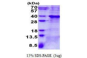 Figure annotation denotes ug of protein loaded and % gel used. (BCL7A Protein)