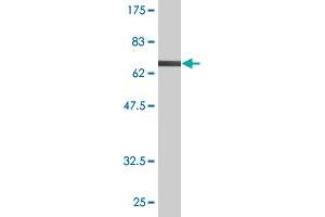 Western Blot detection against Immunogen (74. (Fatty Acid Synthase Antikörper  (AA 1-439))