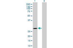 Western Blot analysis of KCTD6 expression in transfected 293T cell line by KCTD6 MaxPab polyclonal antibody. (KCTD6 Antikörper  (AA 1-237))