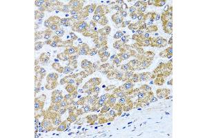 Immunohistochemistry of paraffin-embedded human liver using COL10A1 antibody (ABIN5974149) at dilution of 1/100 (40x lens). (COL10A1 Antikörper)