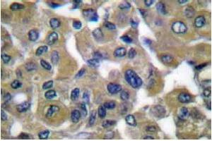 Image no. 1 for anti-Keratin 7 (KRT7) antibody (ABIN265502) (Cytokeratin 7 Antikörper)