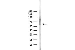 Western blot analysis of lysates from F10-LUC cells(heat-shock,45 min treatment), using CPN2 Antibody at 1/1000 dilution.