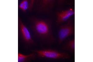 Immunofluorescence staining of methanol-fixed HeLa cells using Phospho-NTRK1-S791 antibody (ABIN2987788). (TRKA Antikörper  (pSer791))