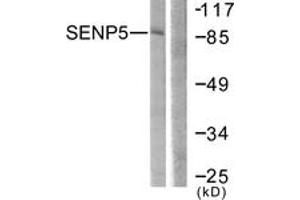 Western Blotting (WB) image for anti-SUMO1/sentrin Specific Peptidase 5 (SENP5) (AA 651-700) antibody (ABIN2889278) (SENP5 Antikörper  (AA 651-700))