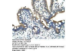 Rabbit Anti-CPNE1 Antibody  Paraffin Embedded Tissue: Human Intestine Cellular Data: Epithelial cells of intestinal villas Antibody Concentration: 4. (CPNE1 Antikörper  (N-Term))