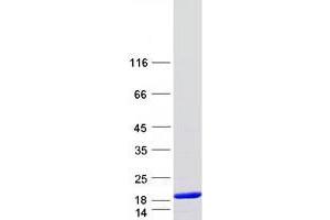 Western Blotting (WB) image for Dynein, Light Chain, Tctex-Type 3 (DYNLT3) protein (Myc-DYKDDDDK Tag) (ABIN2719884)