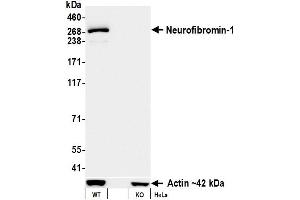 Western Blotting (WB) image for anti-Neurofibromin 1 (NF1) (C-Term) antibody (ABIN7795775) (Rekombinanter Neurofibromin 1 Antikörper  (C-Term))