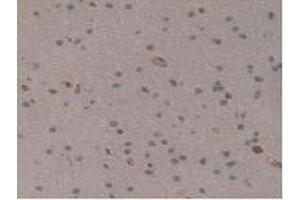 Detection of GM-CSF in Human Brain Tissue using Polyclonal Antibody to Colony Stimulating Factor 2, Granulocyte Macrophage (GM-CSF) (GM-CSF Antikörper  (AA 18-144))