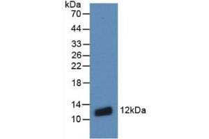 Detection of Recombinant S100A8, Human using Monoclonal Antibody to S100 Calcium Binding Protein A8 (S100A8) (S100A8 Antikörper  (AA 1-93))
