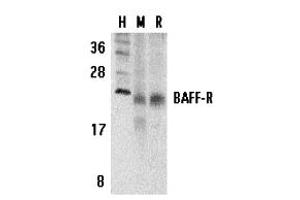 Western Blotting (WB) image for anti-Tumor Necrosis Factor Receptor Superfamily, Member 13C (TNFRSF13C) (C-Term) antibody (ABIN1030280) (TNFRSF13C Antikörper  (C-Term))