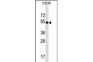 ELL3 Antibody (C-term) (ABIN1537150 and ABIN2849766) western blot analysis in CEM cell line lysates (35 μg/lane). (ELL3 Antikörper  (C-Term))