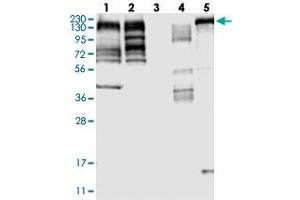 Western blot analysis of Lane 1: RT-4, Lane 2: U-251 MG, Lane 3: Human Plasma, Lane 4: Liver, Lane 5: Tonsil with MLLT4 polyclonal antibody  at 1:250-1:500 dilution.