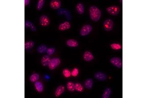 Immunofluorescence (IF) image for anti-Antigen Identified By Monoclonal Antibody Ki-67 (MKI67) (AA 1200-1250) antibody (ABIN7449552) (Rekombinanter Ki-67 Antikörper  (AA 1200-1250))