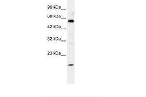 Image no. 1 for anti-Zinc Finger Protein 436 (ZNF436) (AA 104-153) antibody (ABIN202607) (ZNF436 Antikörper  (AA 104-153))