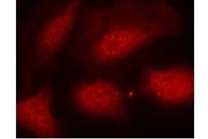 Image no. 3 for anti-Histone H3.1 (HIST1H3B) (pSer10) antibody (ABIN196922) (Histone H3.1 Antikörper  (pSer10))