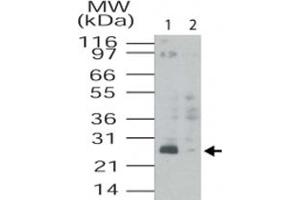 Western blot analysis of TMED4 in HL-60 cell lysates. (TMED4 Antikörper  (AA 55-67))