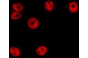 ABIN6276640 staining Hela cells by IF/ICC. (ERG Antikörper  (C-Term))