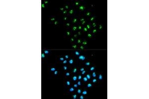 Immunofluorescence analysis of MCF-7 cells using EIF6 antibody. (EIF6 Antikörper  (AA 1-245))