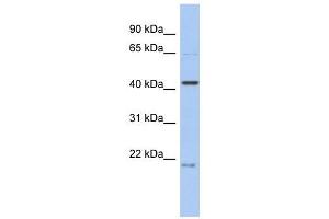 FAM98B antibody used at 1 ug/ml to detect target protein. (FAM98B Antikörper  (N-Term))