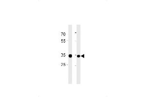 RPLP0P6 Antibody (N-term) (ABIN1881762 and ABIN2843386) western blot analysis in ,PC-3 cell line lysates (35 μg/lane). (RPLP0P6 Antikörper  (N-Term))
