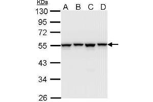 WB Image Sample (30 ug of whole cell lysate) A: A431 , B: H1299 C: Hela D: Hep G2 , 10% SDS PAGE antibody diluted at 1:1000 (HNRNPH1 Antikörper)