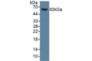 Figure. (KRT9 Antikörper  (AA 315-456))
