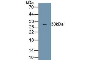 Detection of Recombinant ELA2, Rat using Polyclonal Antibody to Neutrophil Elastase (NE) (ELANE Antikörper  (AA 31-271))