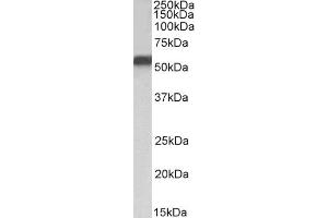 ABIN5857522 (1 µg/ml) staining of HepG2 nuclear lysate (35 µg protein in RIPA buffer). (NR5A2 + LRH1 Antikörper)