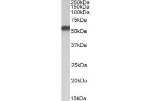 ABIN5857522 (1 µg/ml) staining of HepG2 nuclear lysate (35 µg protein in RIPA buffer). (NR5A2 + LRH1 Antikörper)