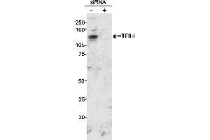 Western Blotting (WB) image for anti-General Transcription Factor III (GTF2I) (C-Term) antibody (ABIN7449365) (GTF2I Antikörper  (C-Term))