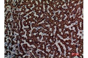 Immunohistochemistry (IHC) image for anti-Enoyl-CoA Delta Isomerase 1 (ECI1) (C-Term) antibody (ABIN3181001)