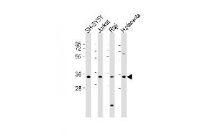 All lanes : Anti-RASSF2 Antibody (Center) at 1:2000 dilution Lane 1: SH-SY5Y whole cell lysates Lane 2: Jurkat whole cell lysates Lane 3: Raji whole cell lysates Lane 4: human placenta lysates Lysates/proteins at 20 μg per lane. (RASSF2 Antikörper  (AA 123-156))