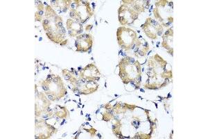 Immunohistochemistry of paraffin-embedded human stomach using RBP2 antibody. (RBP2 Antikörper  (AA 1-134))