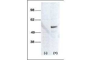 Western blot analysis of anti-STK38L Pab (ABIN392120 and ABIN2841867) transiently transfected HEK-293 cell line lysate (1 μg/lane). (STK38L Antikörper  (C-Term))