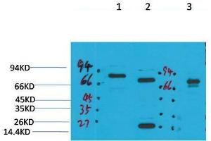 Western Blot (WB) analysis of 1) Rat Brain Tissue, 2)Mouse Brain Tissue, 3) HepG2 with KCNN2(SK2) Rabbit Polyclonal Antibody diluted at 1:2000.